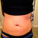 Sad belly button :(