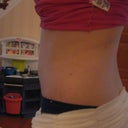 I have a bump over my belly button