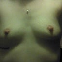 Night before surgery!!
Sorry about the lighting :)
