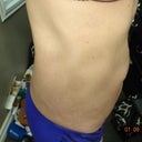 Side view