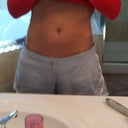 Front - 5 days after procedure - mostly representative of "before"