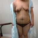 pre-op