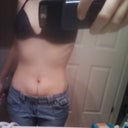 Before surgery.  You can't really even see how much skin there was but it was over 3lbs total.