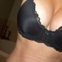 2 months post op