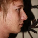 Profile view, 8 days post op.