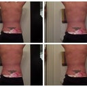 Day of Post Op