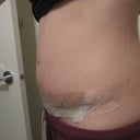 swelling at the end of the same day, just bloated looking