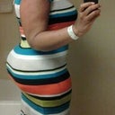 ME 6 days post op...no garment or underwear on underneath dress just my bra