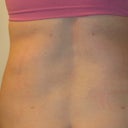 back-still swollen