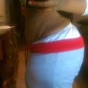 still swollen and puckered on both sides.