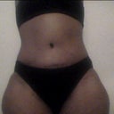 what it looks like with panties over scars and puffines