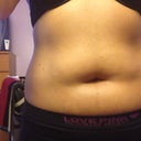 About 2 weeks post