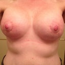 7 wks front - 34DDD