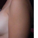 left side view smaller breast
