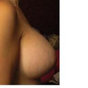 right side view larger breast