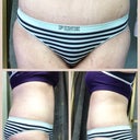 Scar is nice & low, covered by small panties...YAY! 
I know, I know...legs & butt still needs LOTS of work, I'm workin' on it!!!
