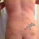 2 weeks back is swollen...I hope that is not dimpling I see.