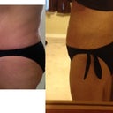 Before and 18 Days After.   I see a big difference in this picture, but when I look at myself, I still see FAT ...  UGH !!    What's wrong with me.