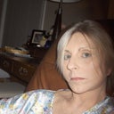 This picture was taken 2 weeks post-op does show bruising on right side - I did put on some makeup