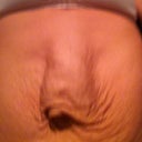 I have major abdominal seperation. My intestines bulge out when I lean back.