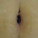 Belly Button healing slowly