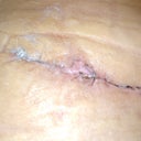 Drain site
