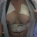 at hospital - 1 hour post op