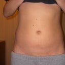 4 weeks- lumpy under the skin but lookin GREAT