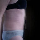 10 weeks PostOp side view. A little bit of swelling in the back and hips, but tummy is so flat!