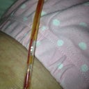 7 Days Post Op. See the long thin clot? Is that a clot or the blood just coagulating?