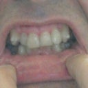 Trays no.20 - big improvement already