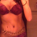 Lighting is awful on this pic.... but standing up (still slightly slouched) 
This is 1 day shy of 2 weeks postop