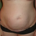 Tummy Before
