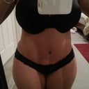 Closer full image - 4 weeks PO