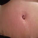 Up close belly button - 4 weeks PO