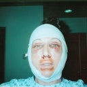 Day# 2 after surgery