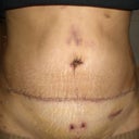 7 days after TT