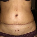 Two weeks after
