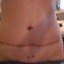 3 months after . Pic taken same day as previous 2