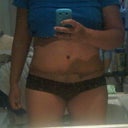 2 1/2 weeks post Op
