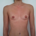 Before - flat as a pancake
