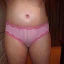Belly button 5 weeks PO - tummy a little swollen today