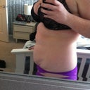 Pre-surgery