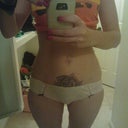 7 weeks post op