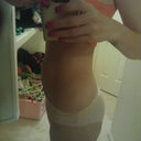 7 weeks post op