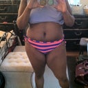 8 Weeks  Post ooop! Still swollen but I'm happy thus far!