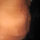 Before side view