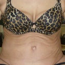 front view sag and wrinkling