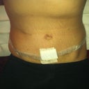 Week 6. Laying in my bed, I could see my hip bones for the first time since I was 7 years old probably lol