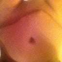 My scar today 12/19/2012